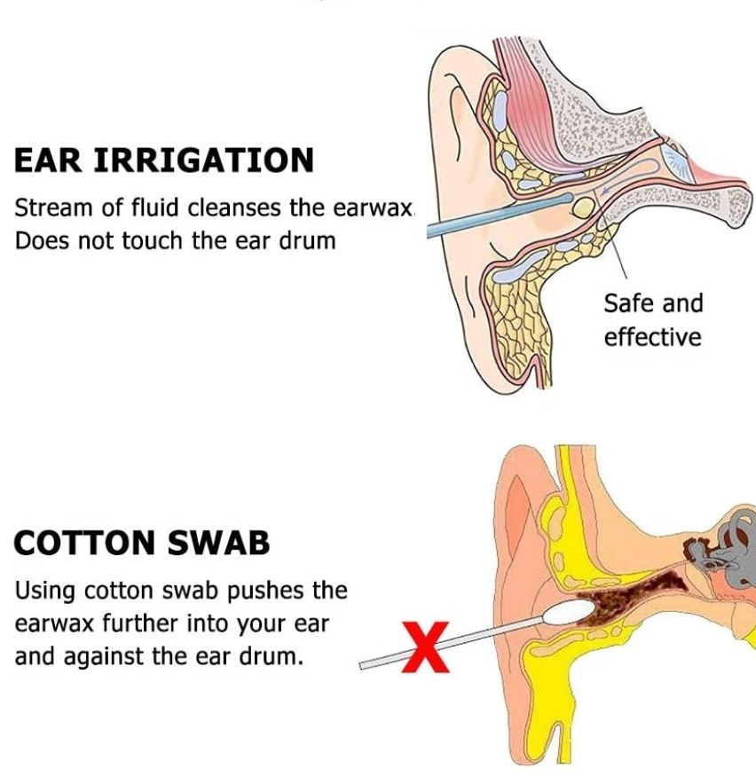 Ear Washer and Ear Irrigation Kit: image 7